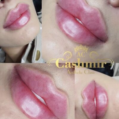 Szkolenie + trening modelowanie ust